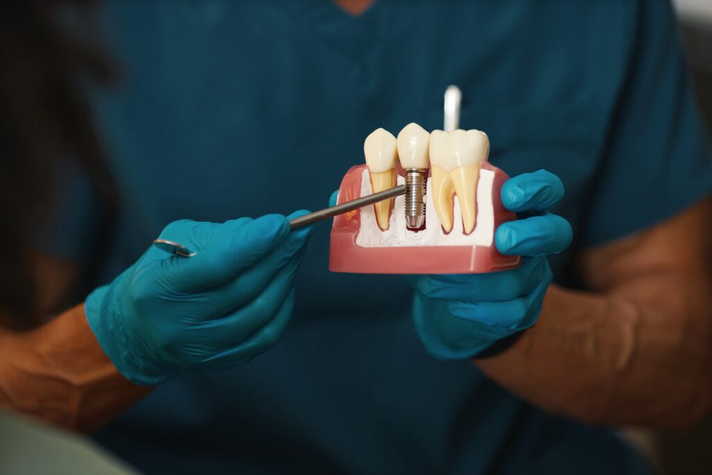 Dental Implants Medford