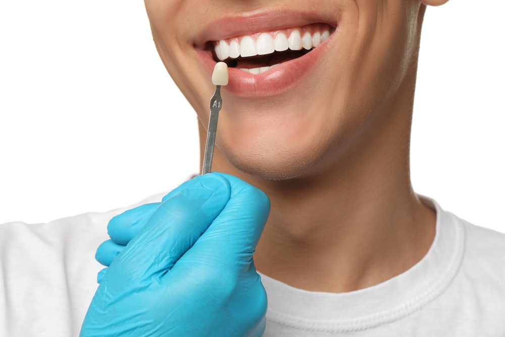 Dental Veneers in Medford